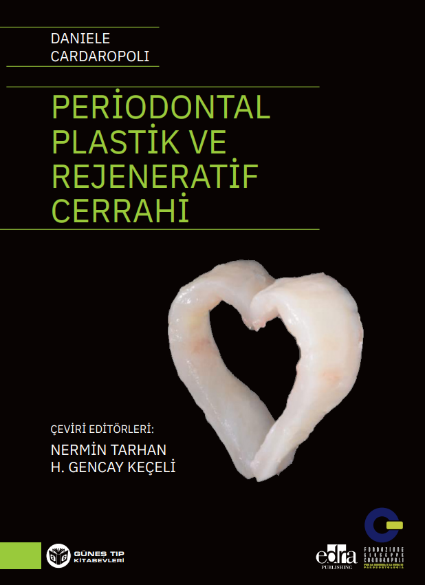 Periodontal Plastik ve Rejeneratif Cerrahi