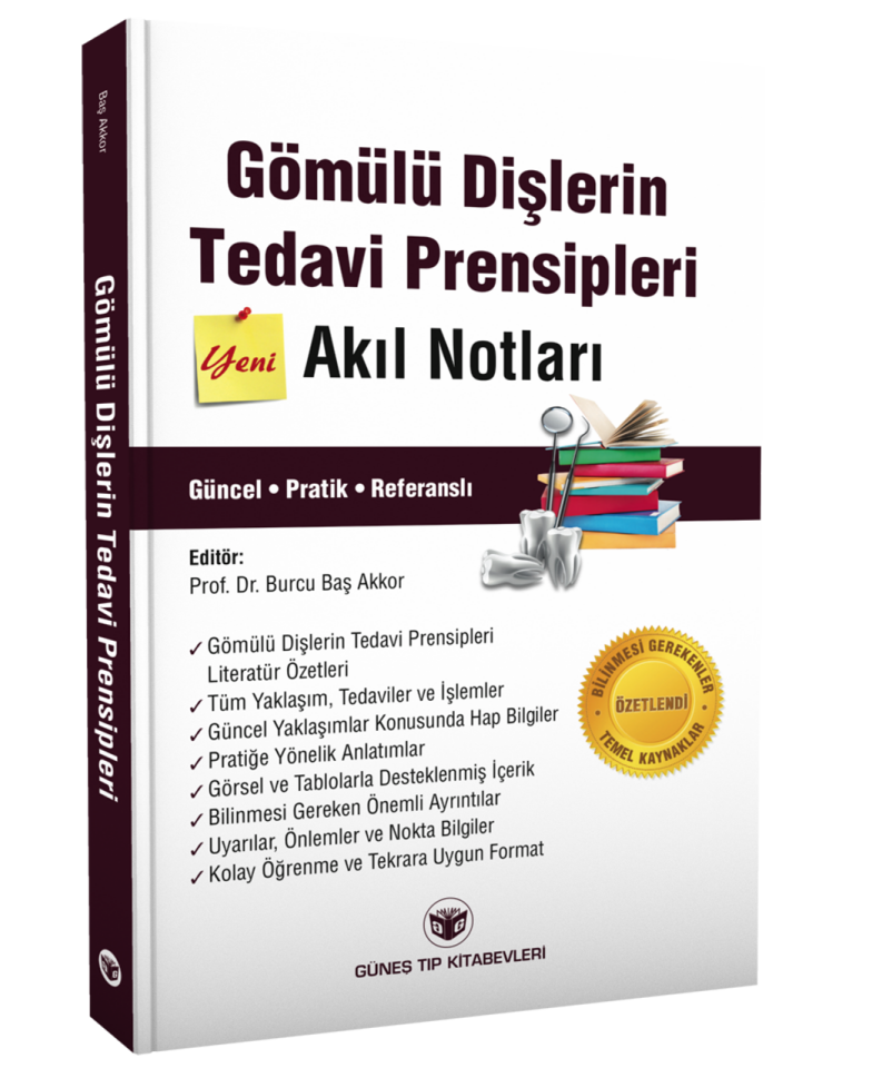 Gömülü Dişlerin Tedavi Prensipleri Akıl Notları