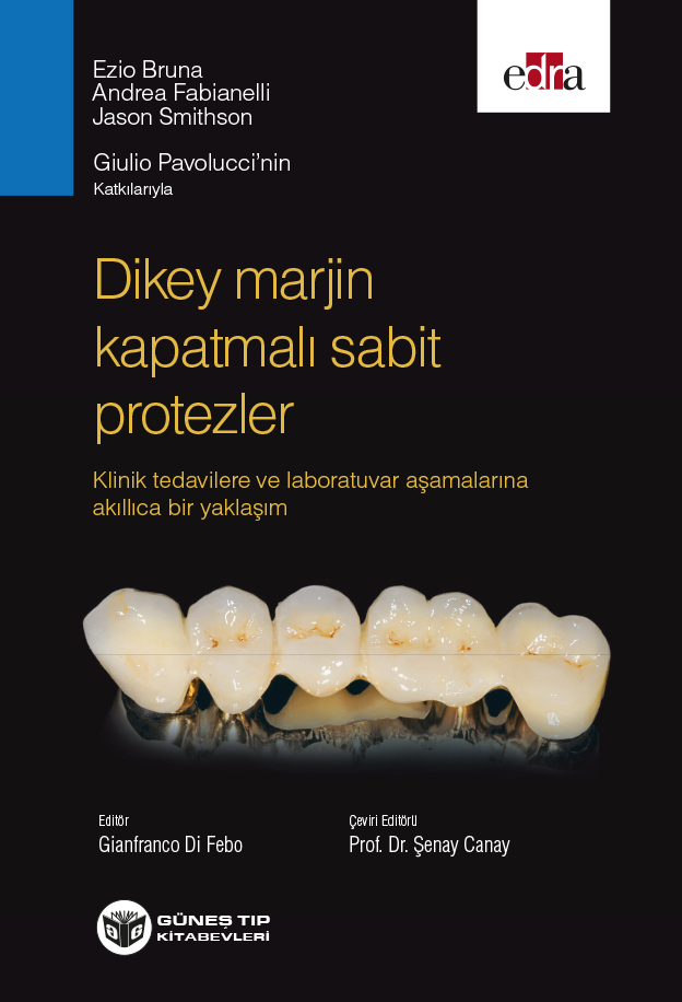 Dikey Marjin Kapatmalı Sabit Protezler