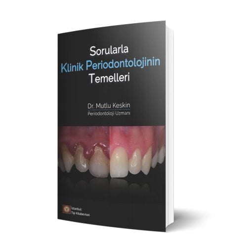 Sorularla Klinik Periodontolojinin Temelleri