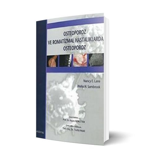 Osteoporoz ve Romatizmal Hastalıklarda Osteoporoz