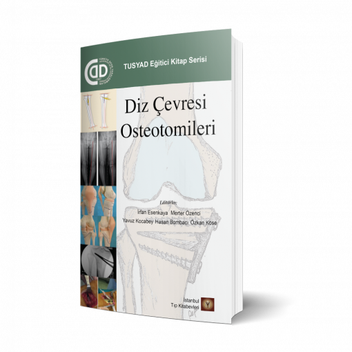 Diz Çevresi Osteotomileri