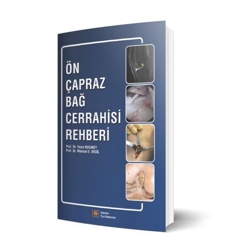 Ön Çapraz Bağ Cerrahisi Rehberi