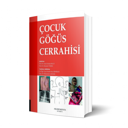 Çocuk Göğüs Cerrahisi