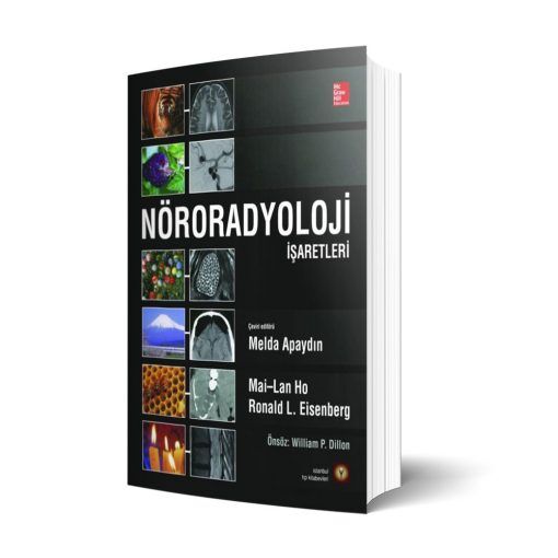 Nöroradyoloji İşaretleri