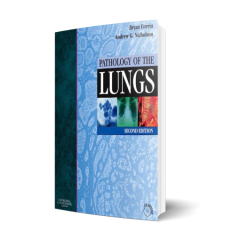 Pathology of the Lungs 2nd Edition