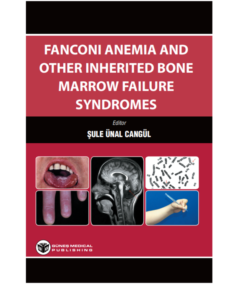 Fanconi Anemia And Other Inherited Bone Marrow Failure Syndromes