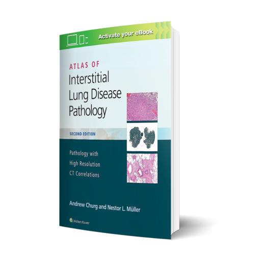 Atlas of Interstitial Lung Disease Pathology 2nd Edition