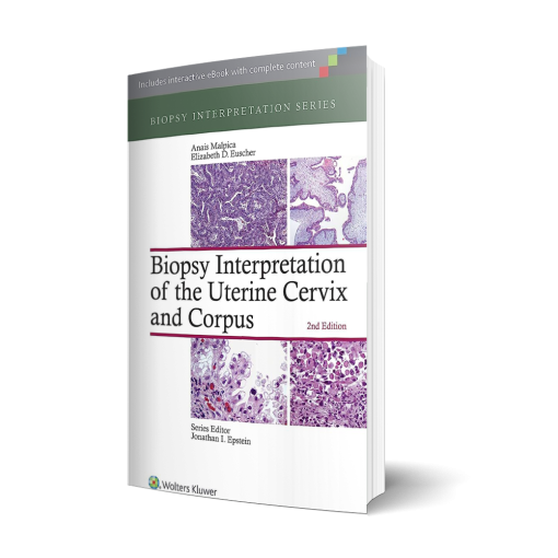 Biopsy Interpretation of the Uterine Cervix and Corpus (Biopsy Interpretation Series) Second Edition