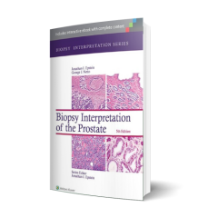 Biopsy Interpretation of the Prostate