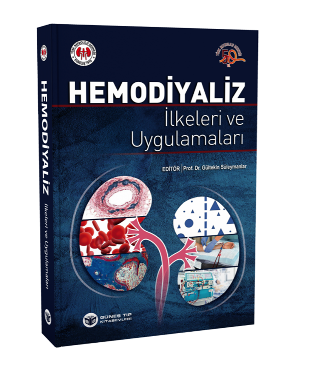 Hemodiyaliz İlkeleri ve Uygulamaları