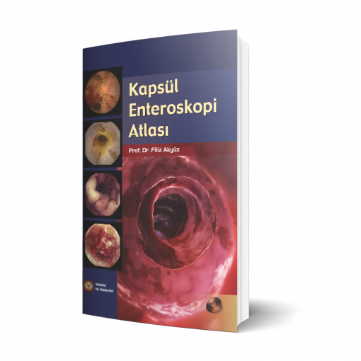 Kapsül Enteroskopi Atlası