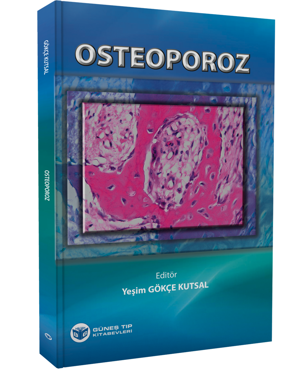 Osteoporoz