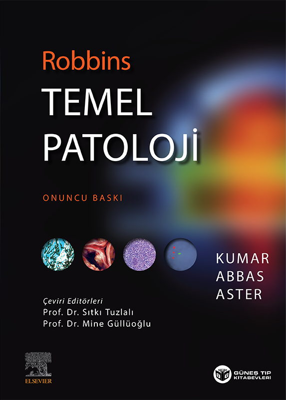 Robbins Temel Patoloji