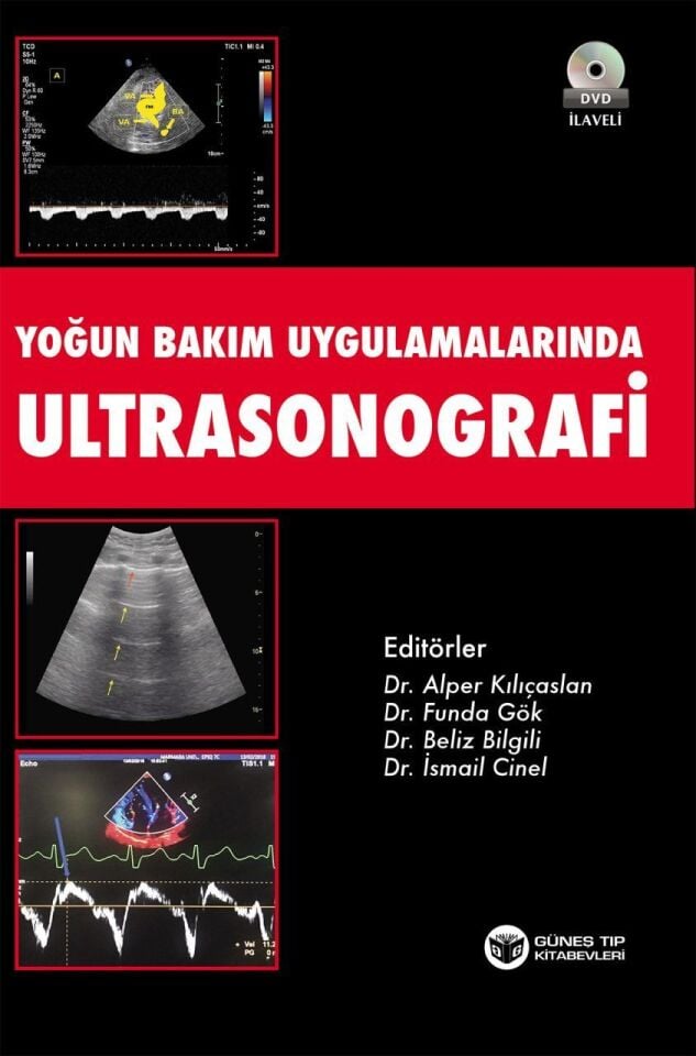 Yoğun Bakım Uygulamalarında Ultrasonografi + DVD