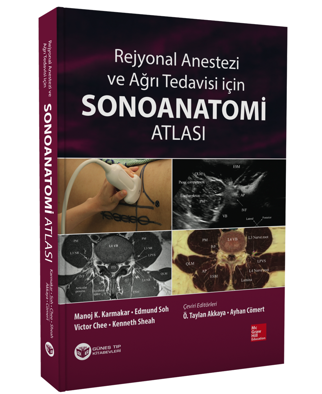 Rejyonal Anestezi ve Ağrı Tedavisi İçin Sonoanatomi Atlası