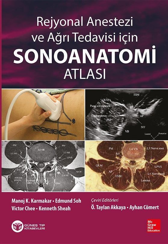 Rejyonal Anestezi ve Ağrı Tedavisi İçin Sonoanatomi Atlası