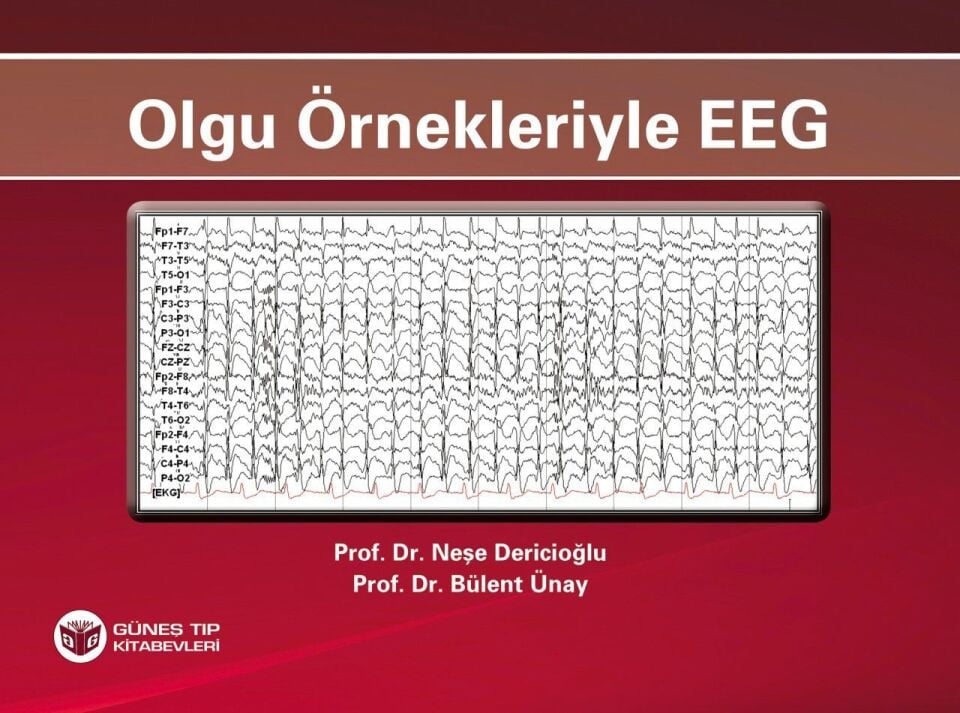 Olgu Örnekleriyle EEG