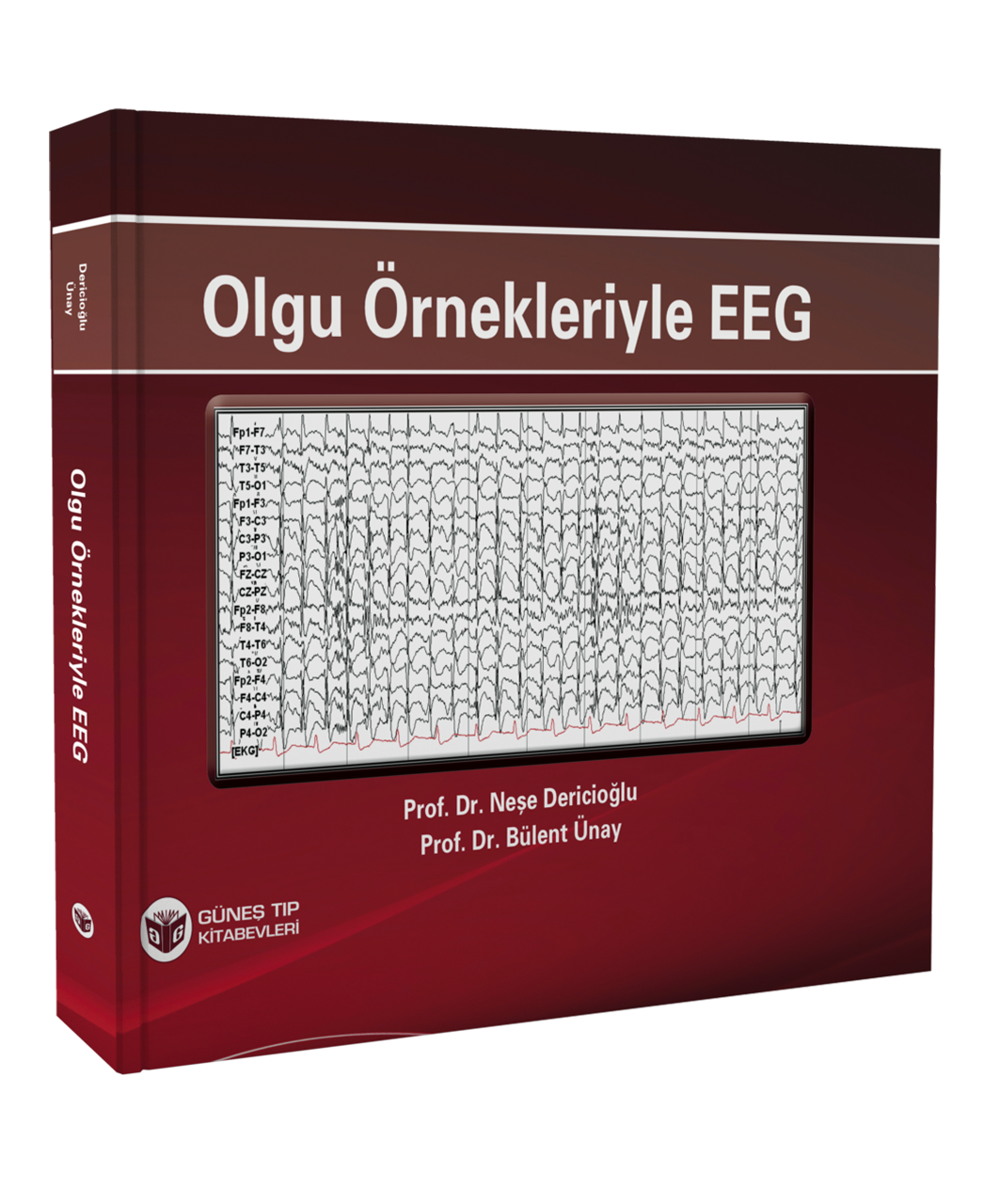 Olgu Örnekleriyle EEG