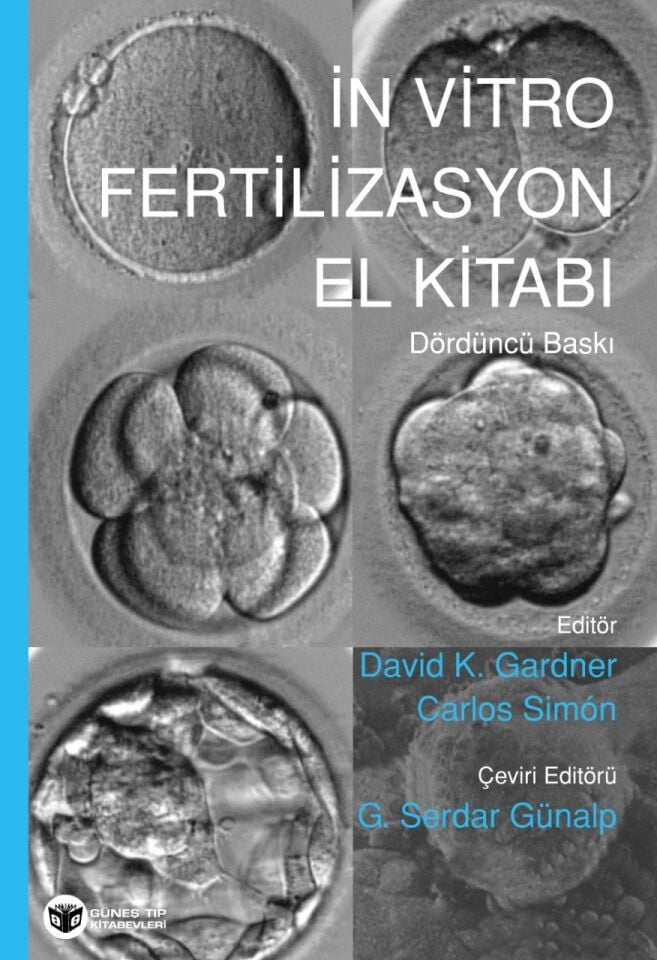 İn Vitro Fertilizasyon El Kitabı