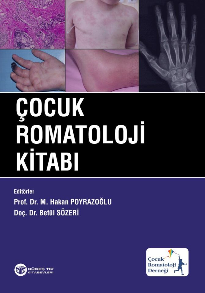 Çocuk Romatoloji Kitabı