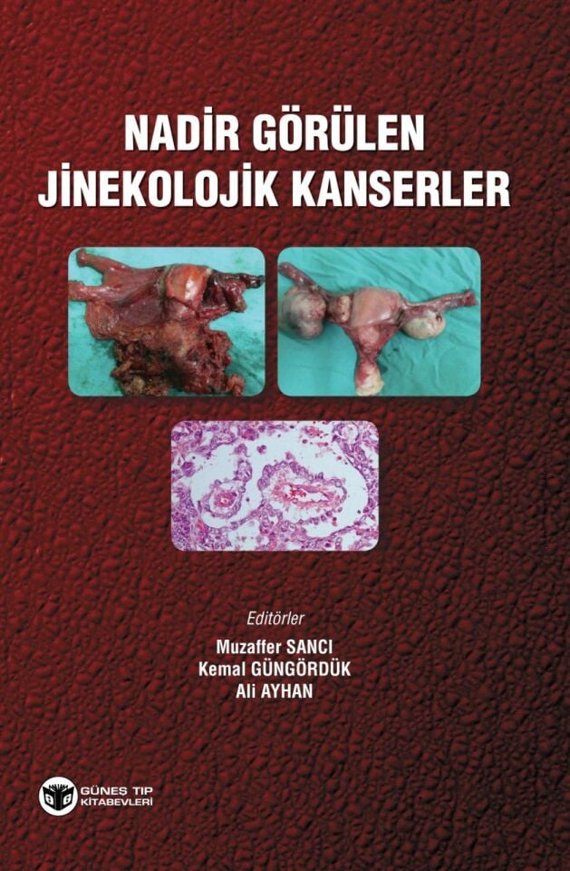 Nadir Görülen Jinekolojik Kanserler