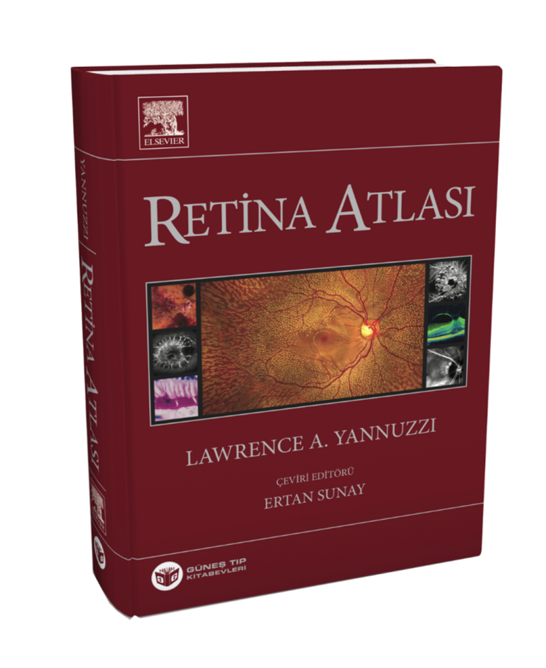 Yannuzzi Retina Atlası