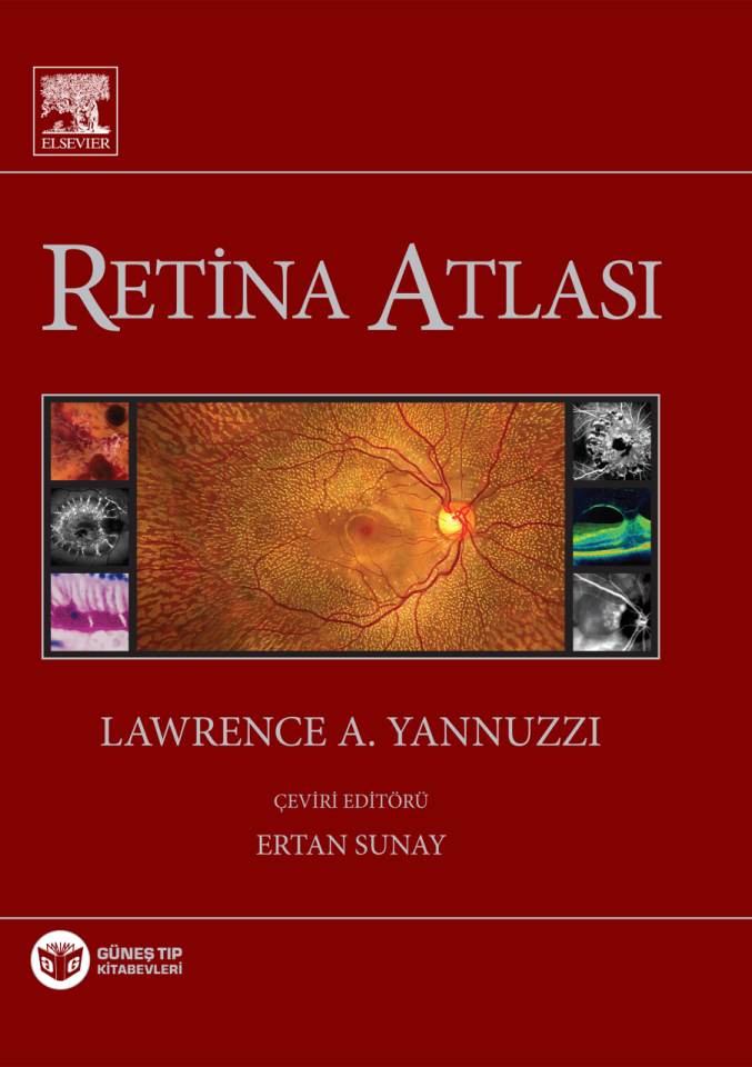 Yannuzzi Retina Atlası