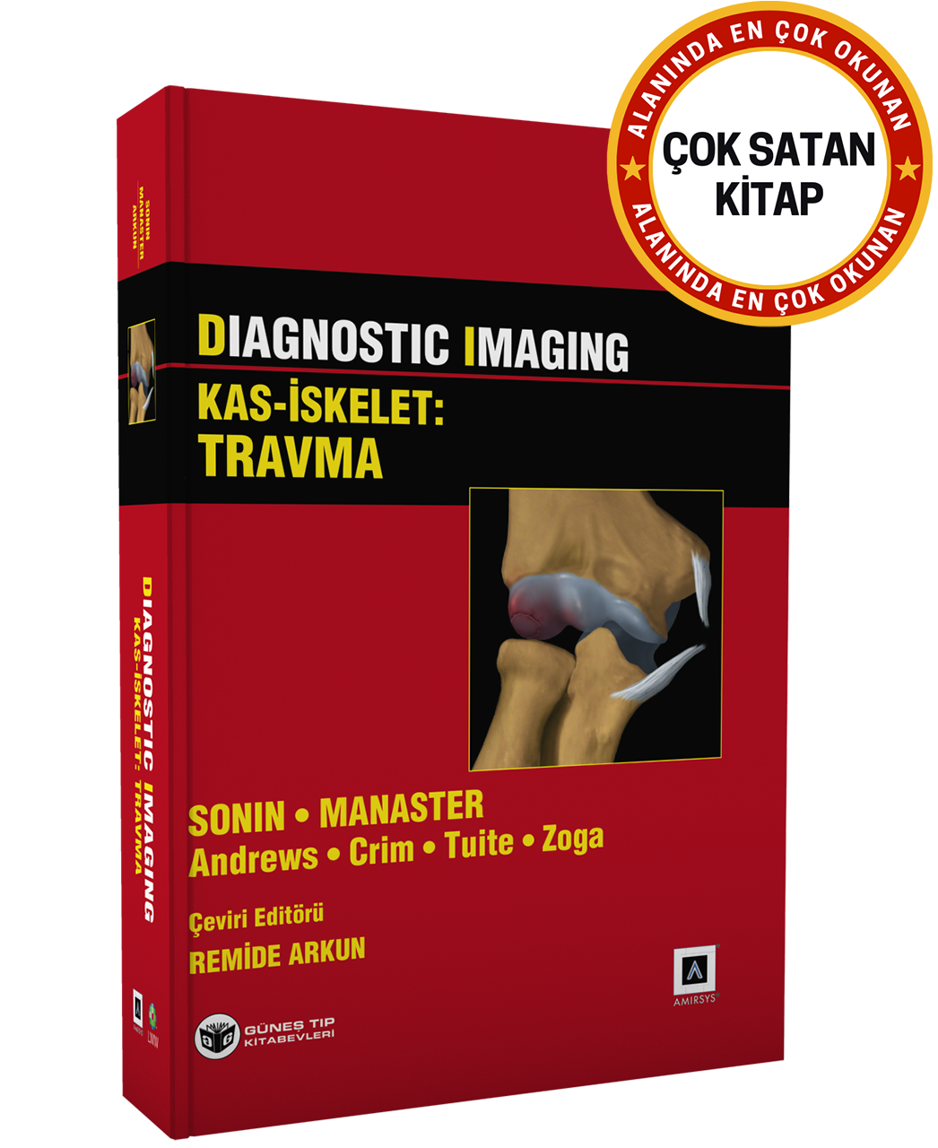 Diagnostic Imaging - Kas İskelet: Travma