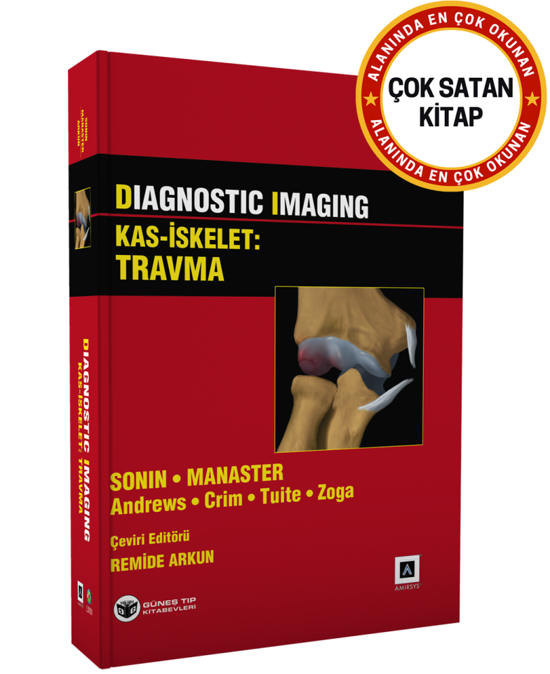 Diagnostic Imaging - Kas İskelet: Travma