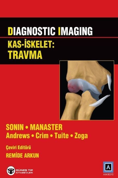 Diagnostic Imaging - Kas İskelet: Travma