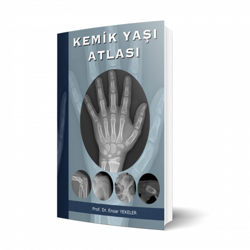 Kemik Yaşı Atlası