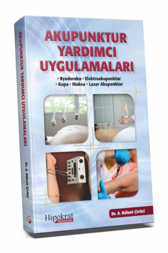 Akupunktur Yardımcı Uygulamaları