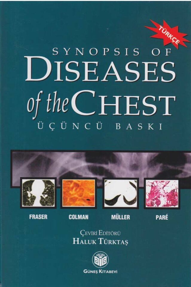 Synopsis of Diseases of The Chest (Türkçesi)