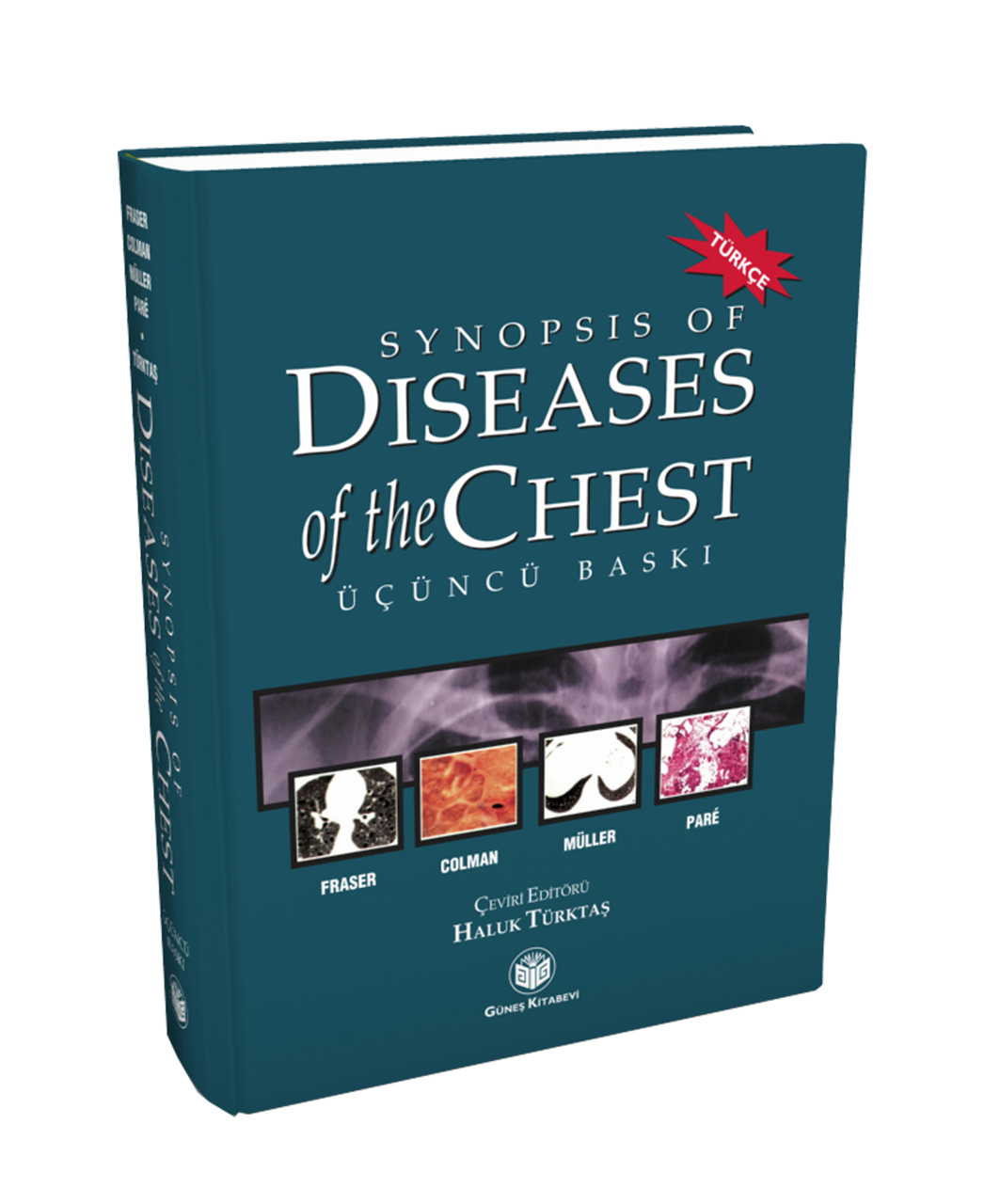 Synopsis of Diseases of The Chest (Türkçesi)