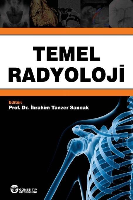 Temel Radyoloji