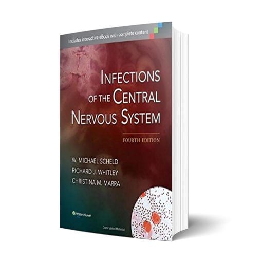 Infections of the Central Nervous System