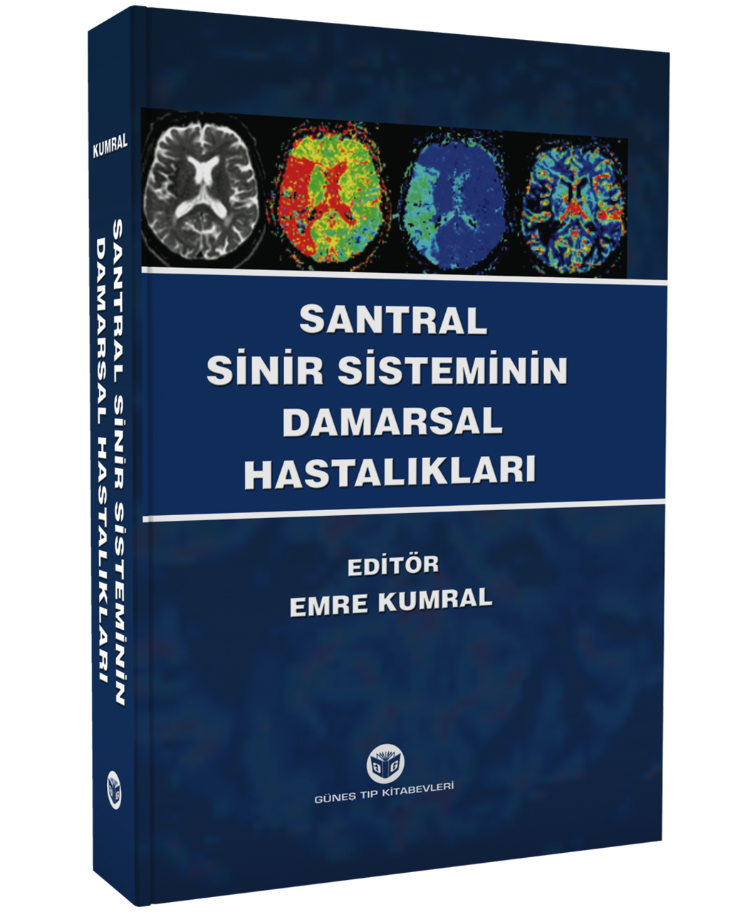 Santral Sinir Sisteminin Damarsal Hastalıkları