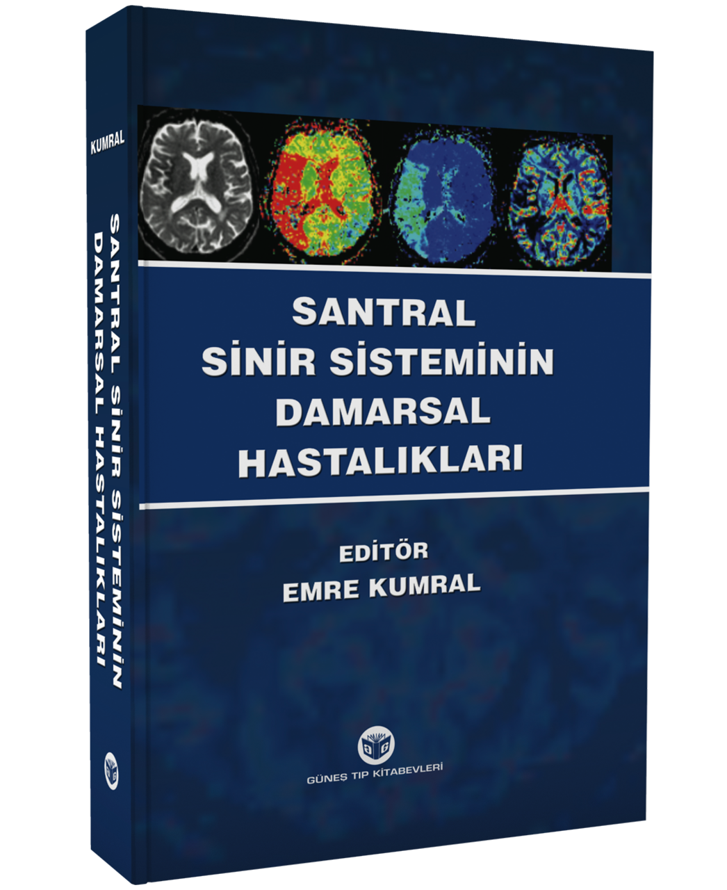 Santral Sinir Sisteminin Damarsal Hastalıkları