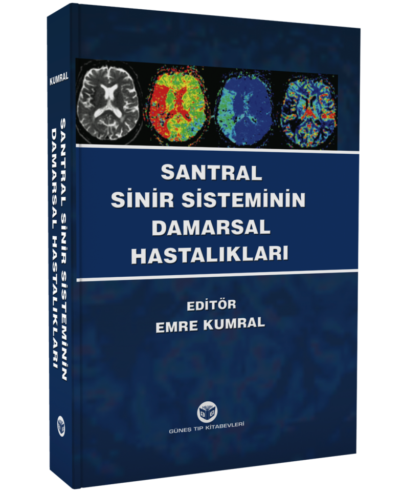 Santral Sinir Sisteminin Damarsal Hastalıkları