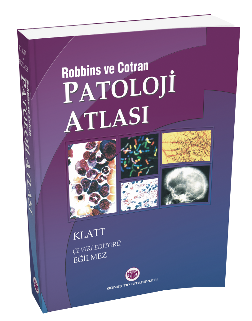 Robbins Patoloji Atlası