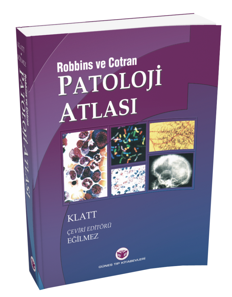 Robbins Patoloji Atlası