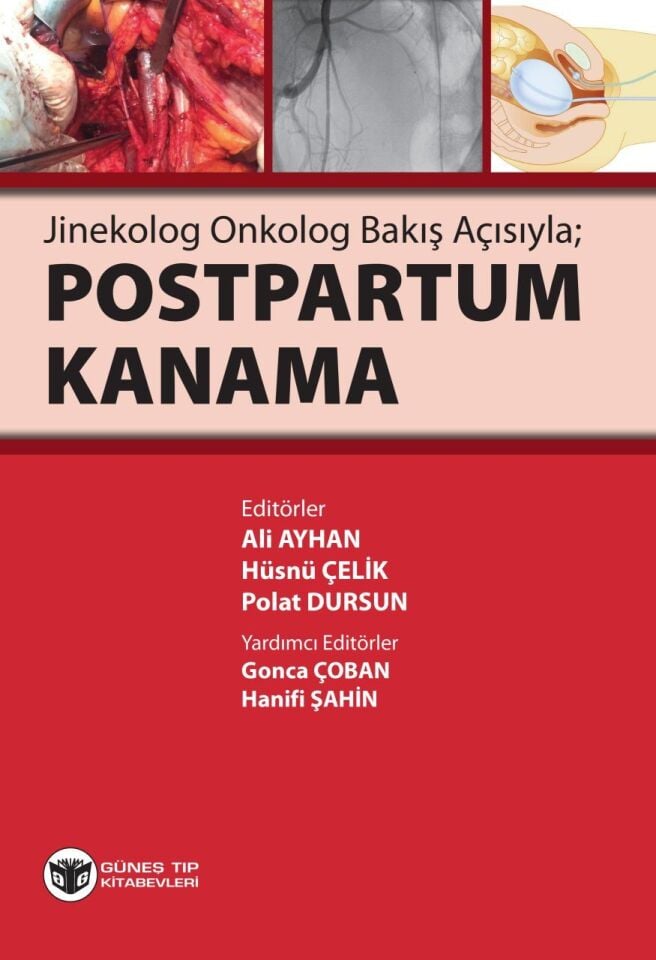 Postpartum Kanama