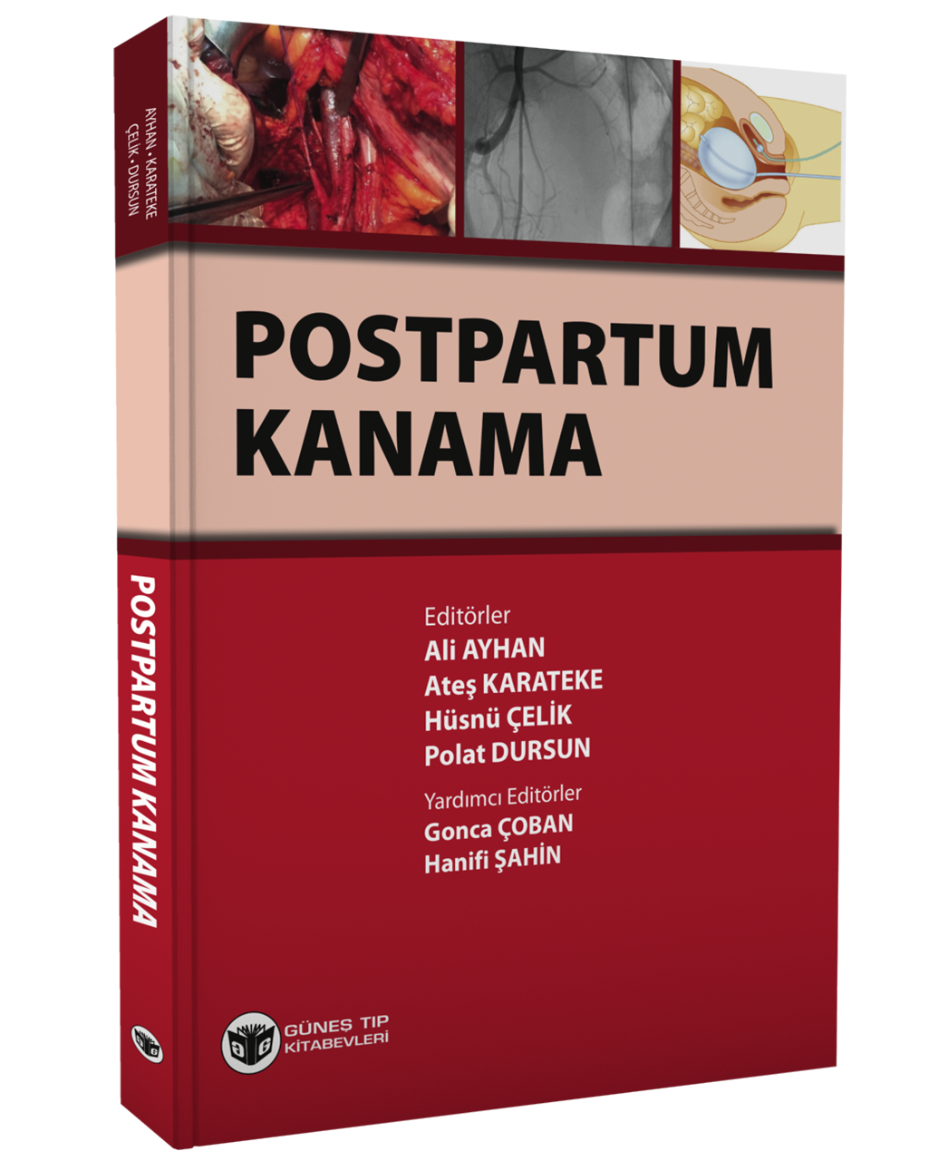 Postpartum Kanama