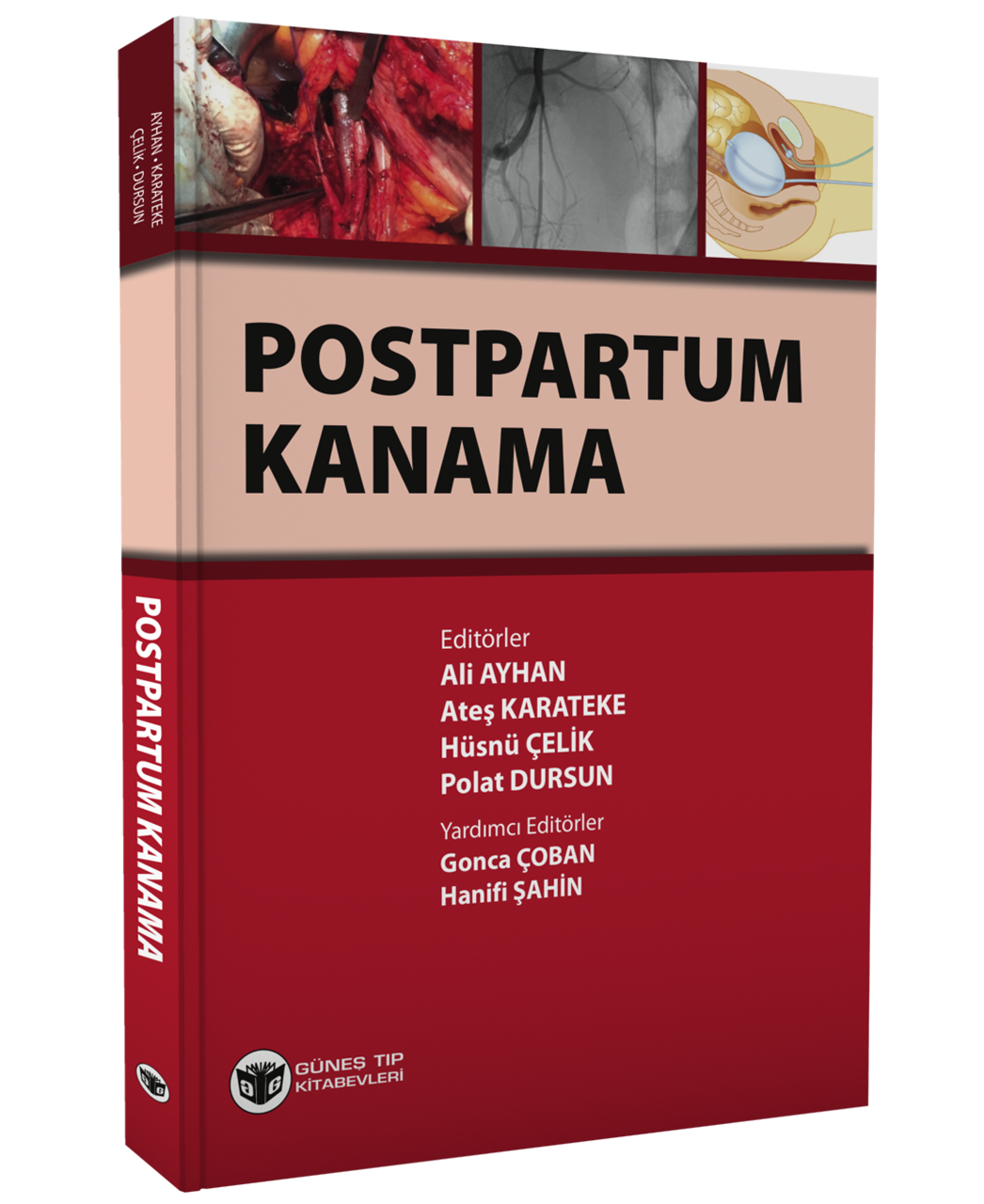 Postpartum Kanama