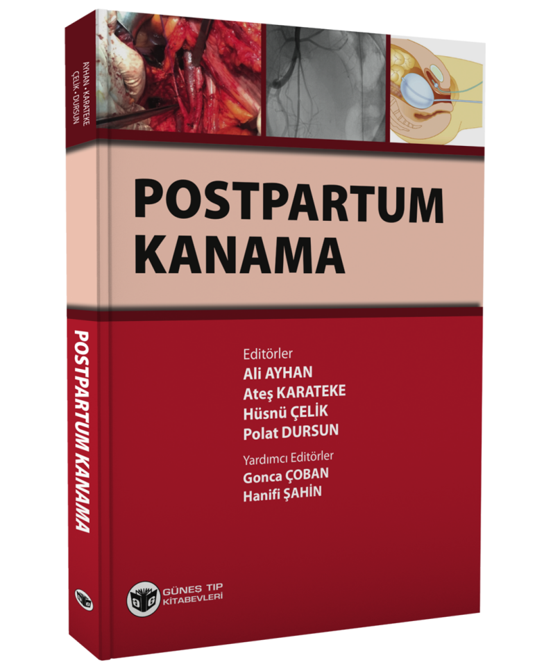 Postpartum Kanama