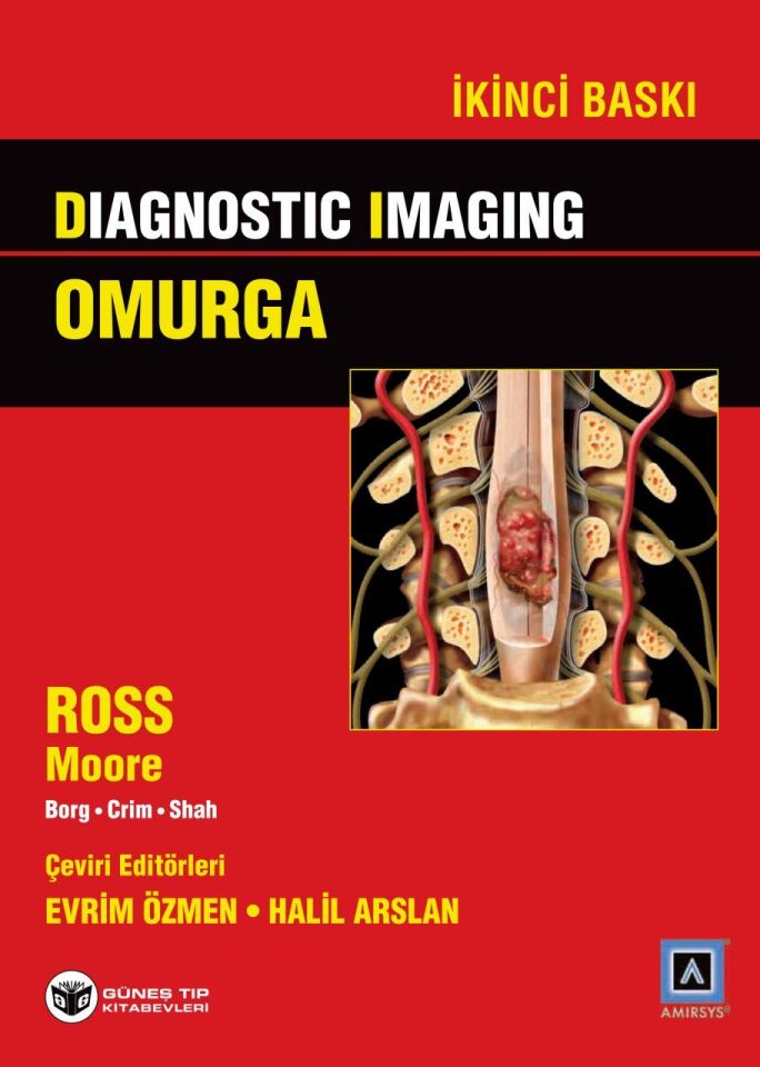 Diagnostic Imaging - Omurga