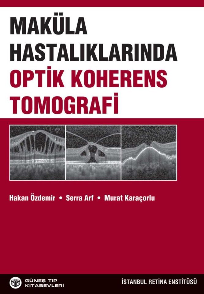 Maküla Hastalıklarında Optik Koherens Tomografi