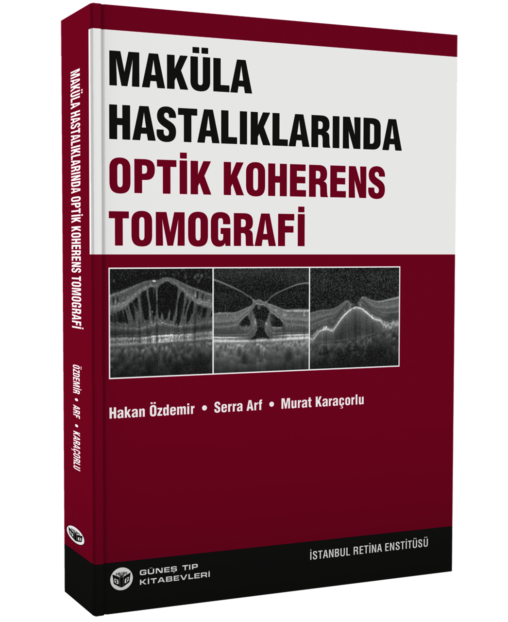 Maküla Hastalıklarında Optik Koherens Tomografi