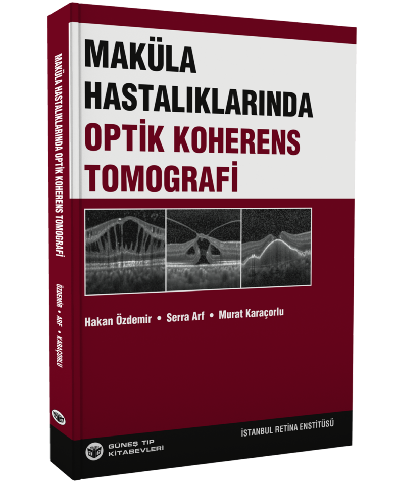 Maküla Hastalıklarında Optik Koherens Tomografi